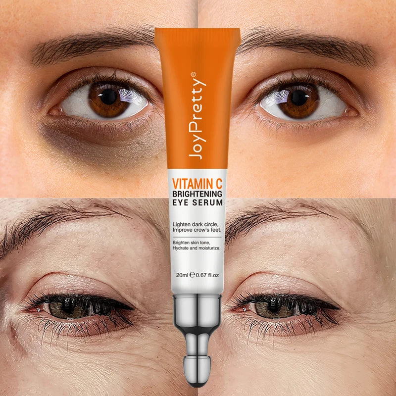 JoyPretty Anti Dark Circle Eye Cream - Greycord