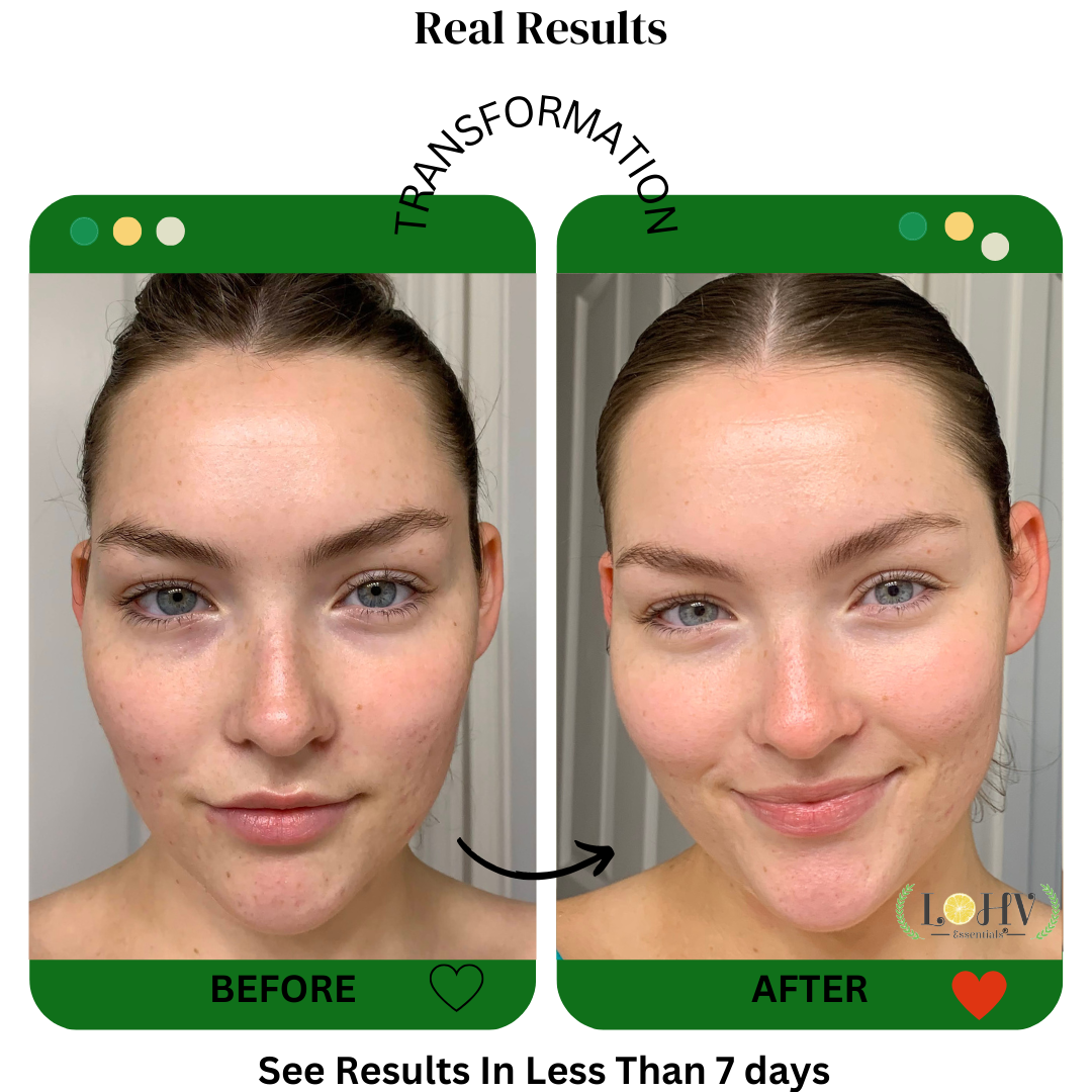 LOHV PureBalance Hydrating Cleanser