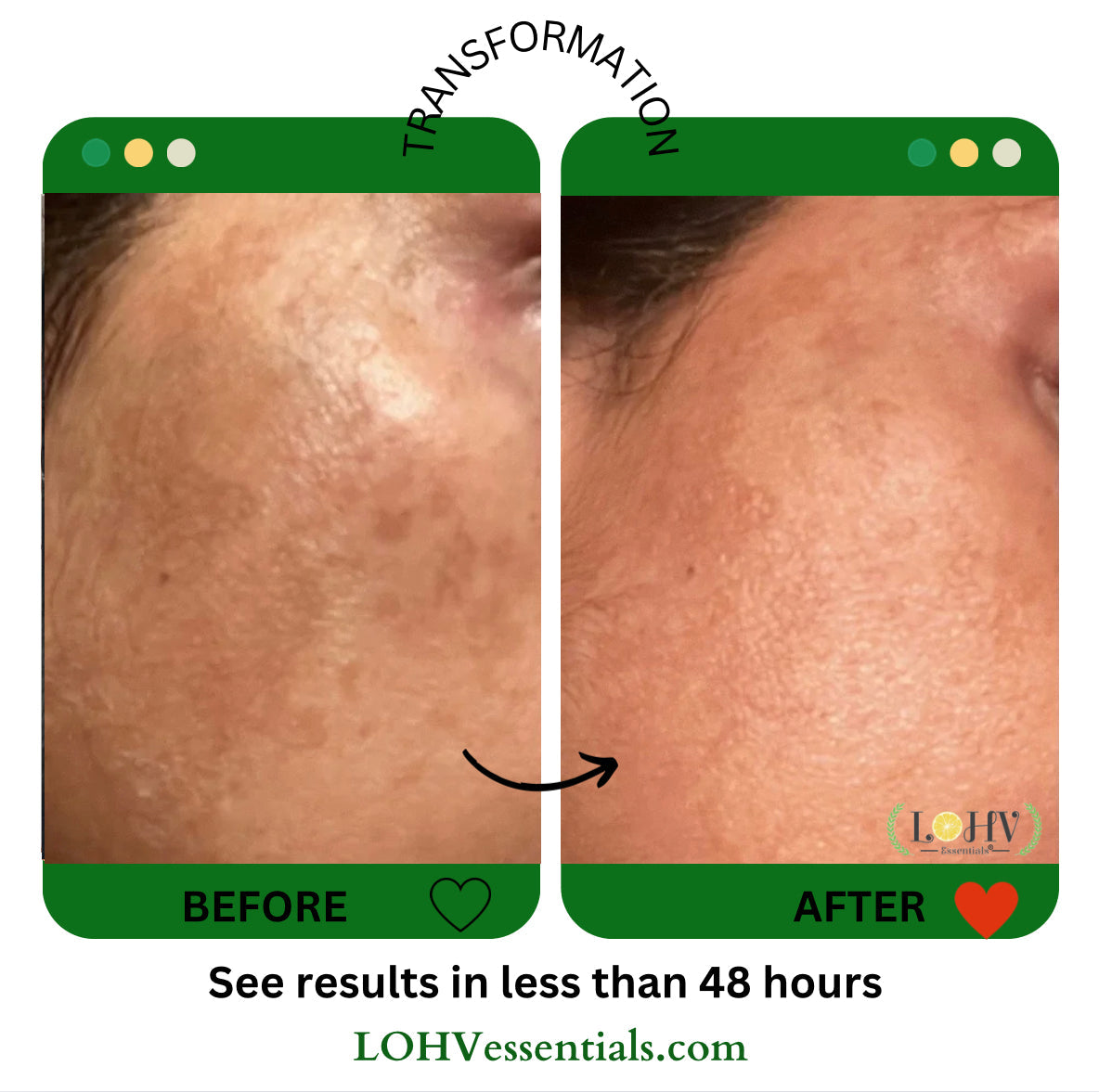 LOHV PureBalance Hydrating Cleanser