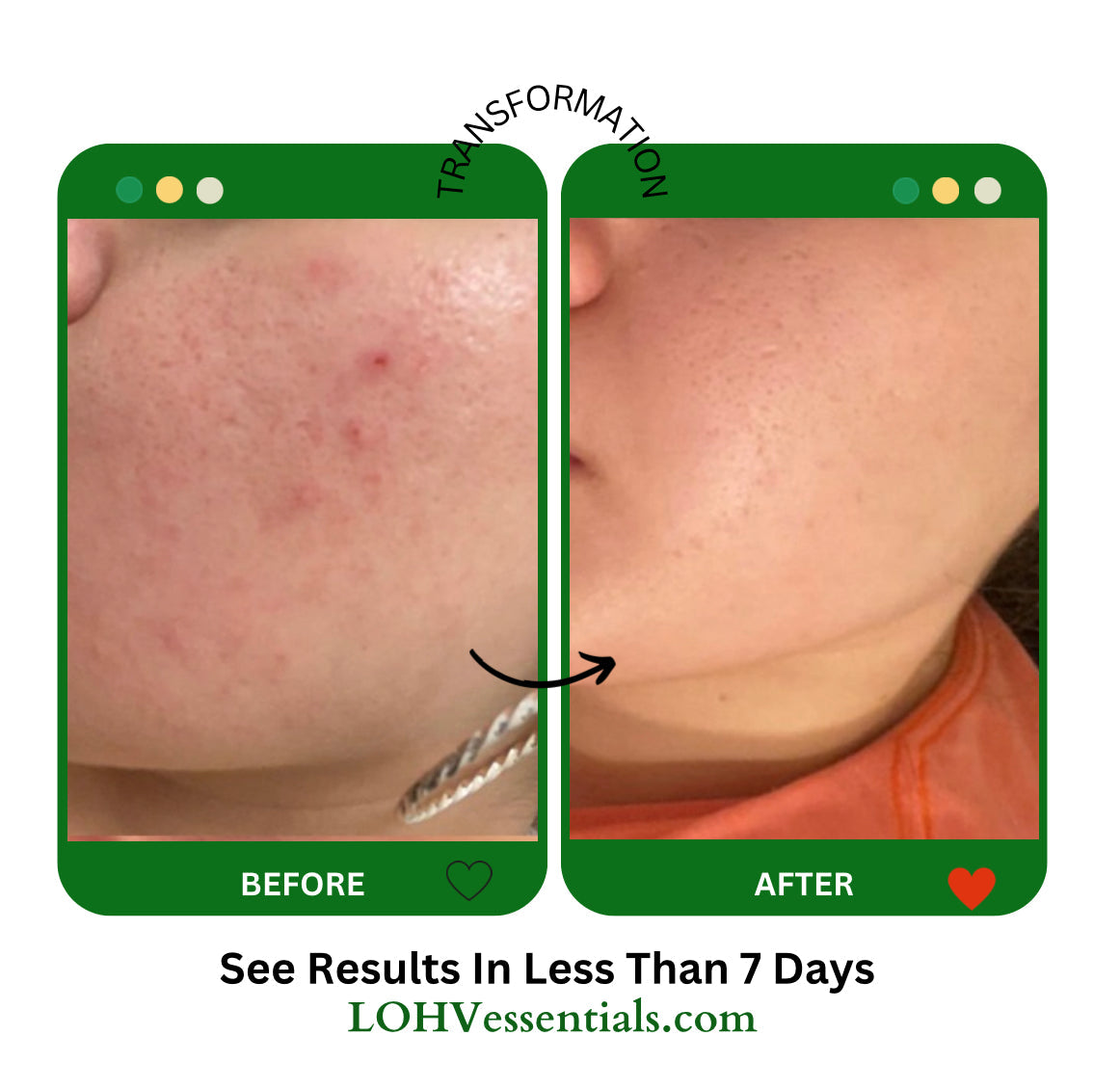 LOHV PureBalance Hydrating Cleanser