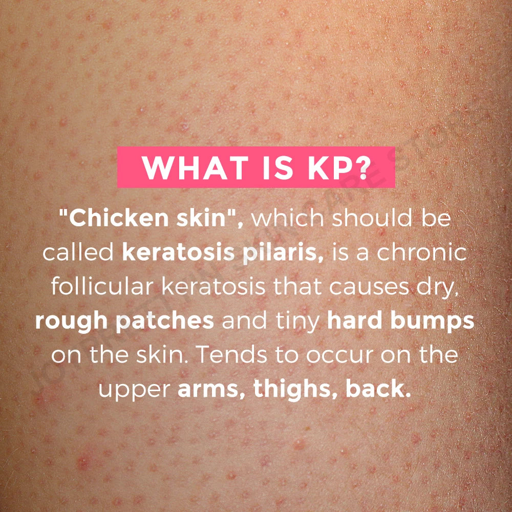 JoyPretty Exfoliating Skin Repair Cream - Greycord