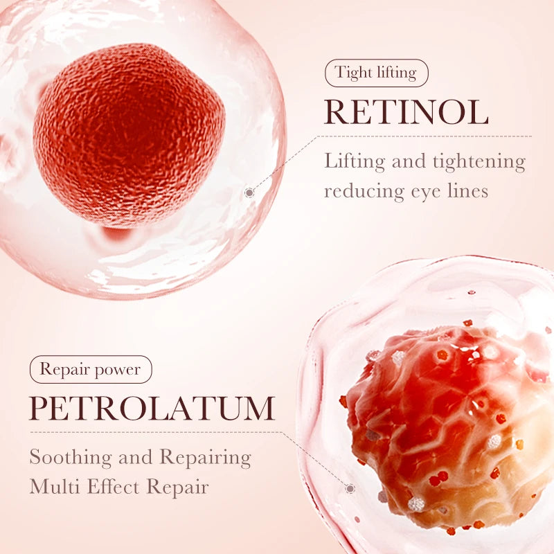 Retinol Eye Cream, Reduces Dark Circles and Wrinkles, Moisturizes and Tightens The Eyes