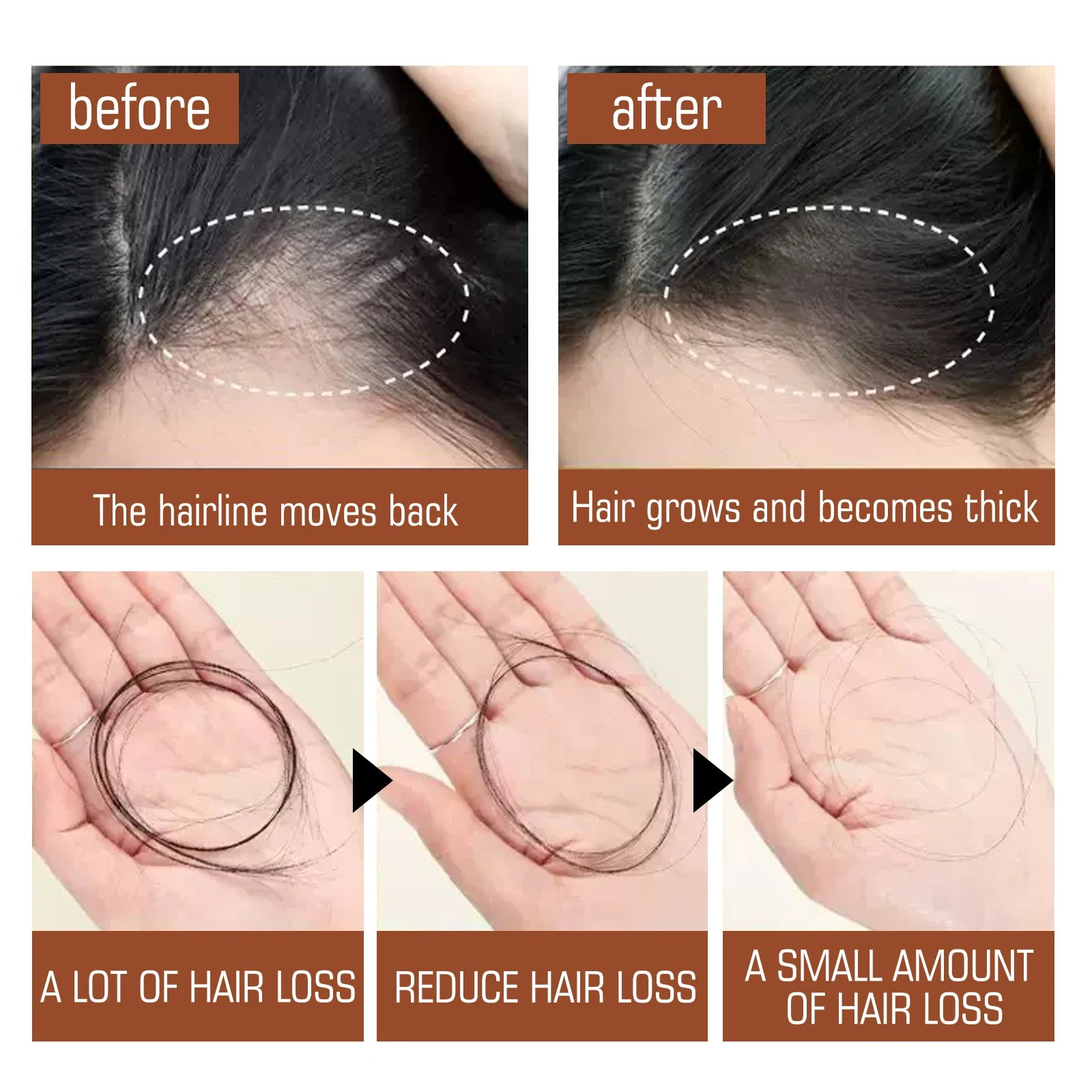 Batana Renew Hair Growth Mask With 100% Pure Batana Oil