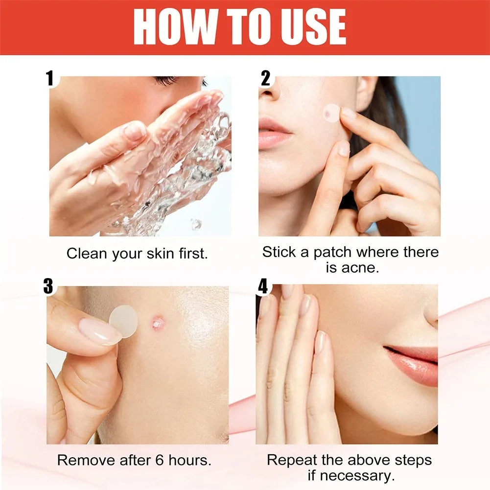 StarPatch – 240pcs Acne Stickers Heart, Star & More | Cover & Heal