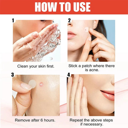 StarPatch – 240pcs Acne Stickers Heart, Star & More | Cover & Heal